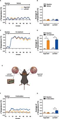 Electrical Neurostimulation Promotes Brown Adipose Tissue Thermogenesis